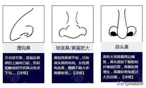 鼻生瘡面相|鼻相分析10款｜鼻樑有節及橫紋、豬膽鼻、鼻頭下垂代表甚麼？姻 